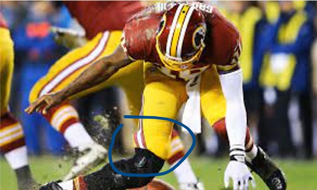 Non-contact knee injury on field